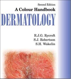 Dr Wakelin Handbook Dermatology
